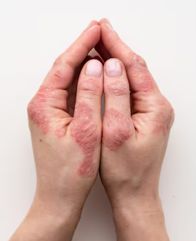 practices.cutFire.imageAlt